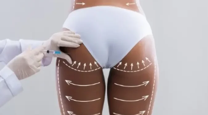 UK Bans Brazilian Butt Lift Ads Over Safety and Body Image Concerns