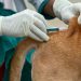 UK rabies death Morocco 2025